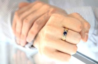 Blackened finger from a gold ring